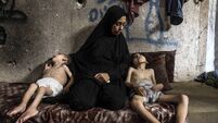 Two Palestinian brothers suffer from malnutrition amid Israeli attacks on Gaza