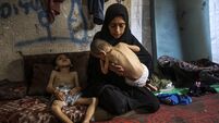 Two Palestinian brothers suffer from malnutrition amid Israeli attacks on Gaza